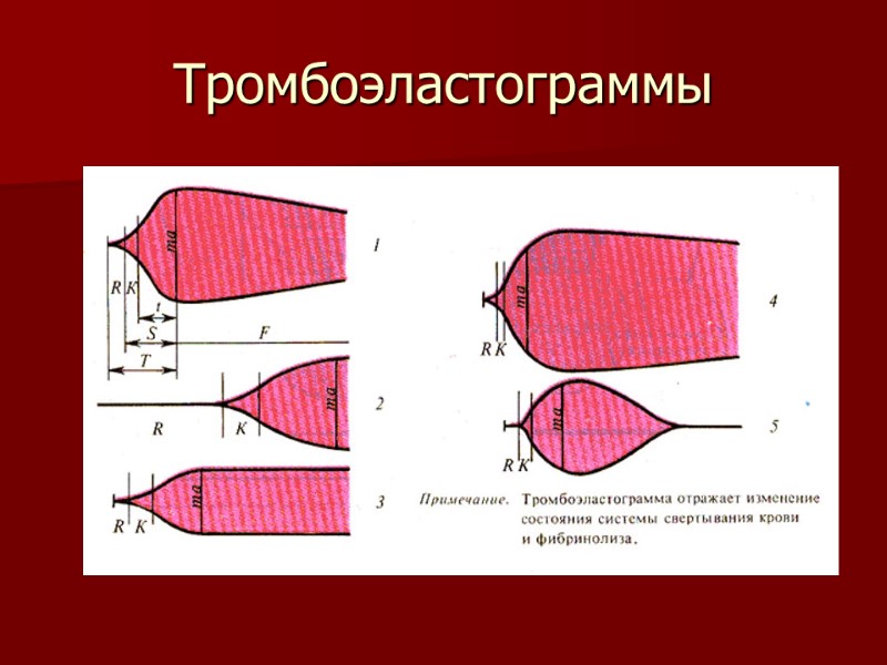 Тромбоэластограммы